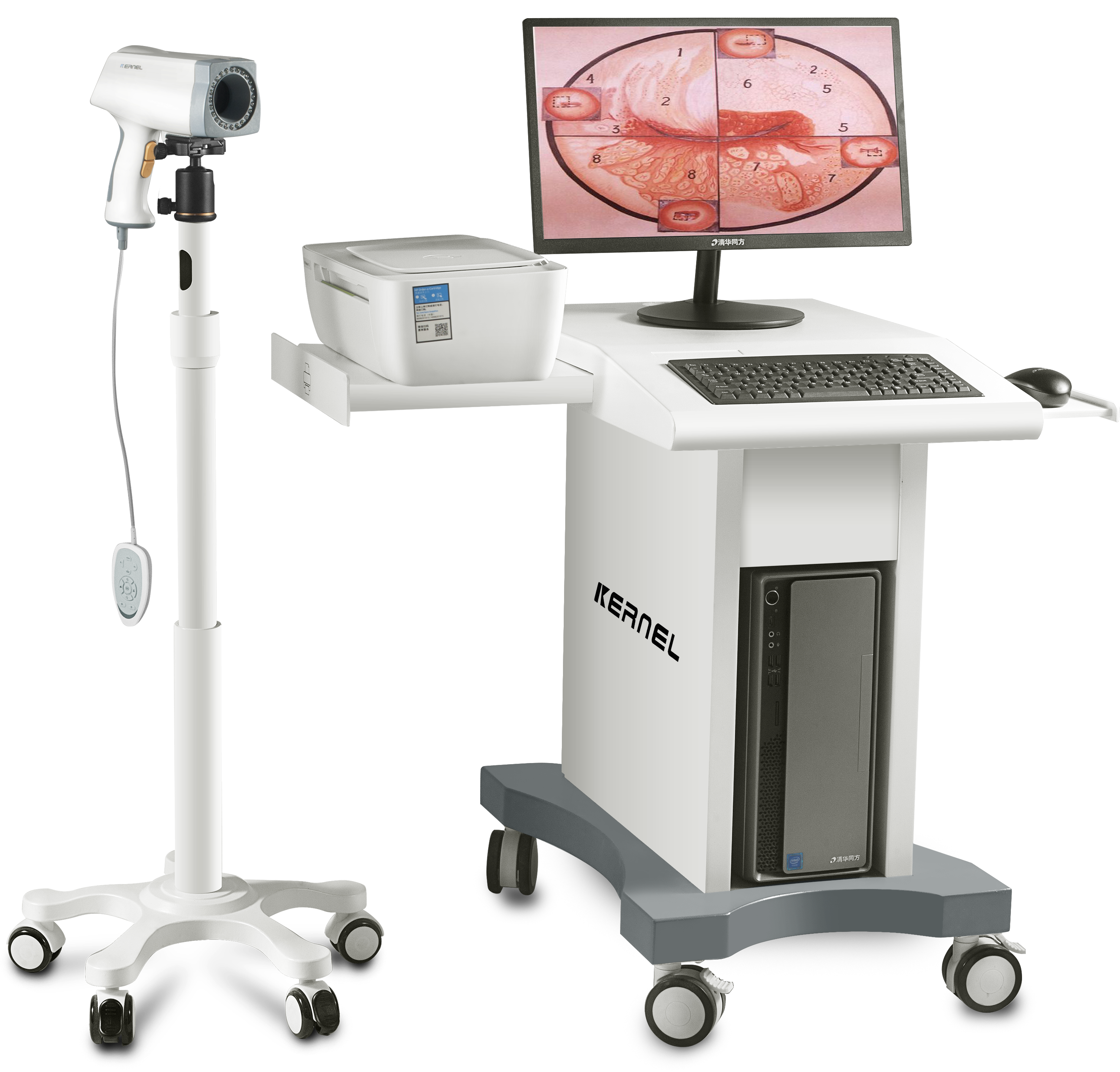 Colposcope Digital Imaging System