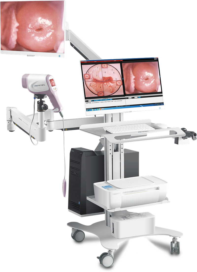 Colposcope Digital Imaging System Kn-2200i