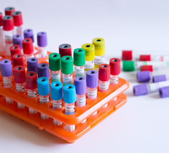 Vaccum Blood Specimen Collection Tubes