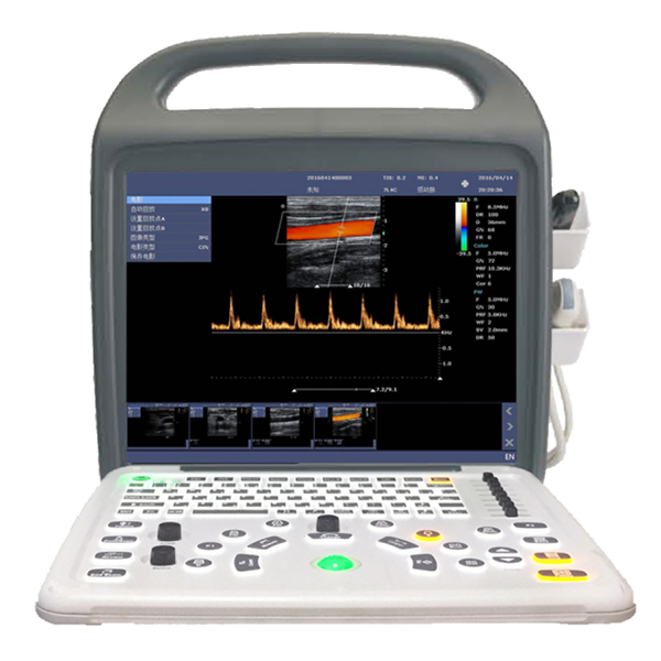 Portable Color Doppler Ultrasound Scanner