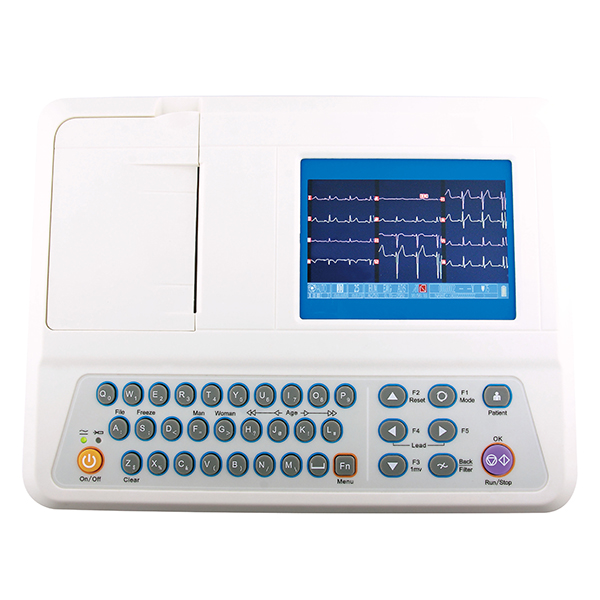 ECG