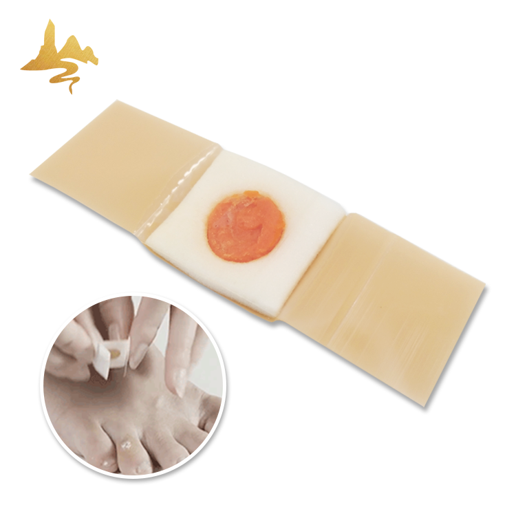 Corn Removal Plaster