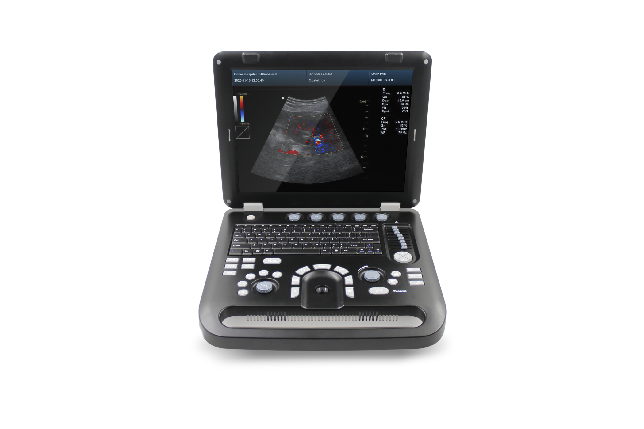 CMS1700C Portable color ultrasound